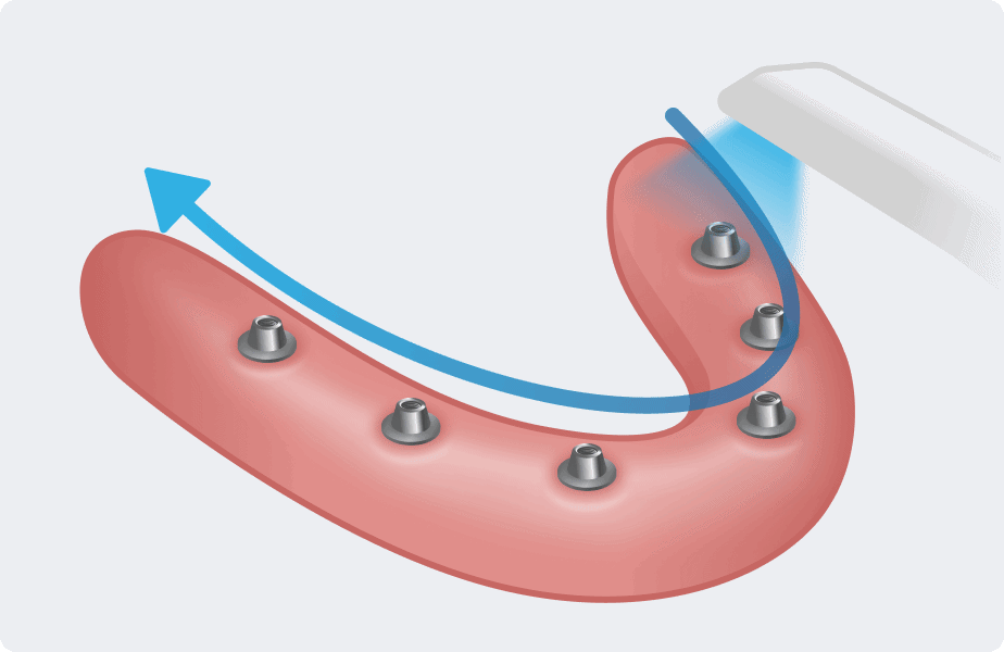 Lower Edentulous Scan.gif