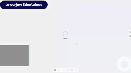 본치과 하악 GIF.gif