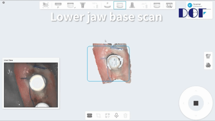 lowerjaw edentulous scan.gif