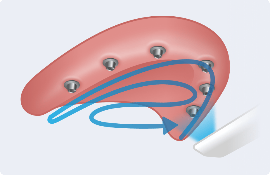 Upper Edentulous Scan.gif